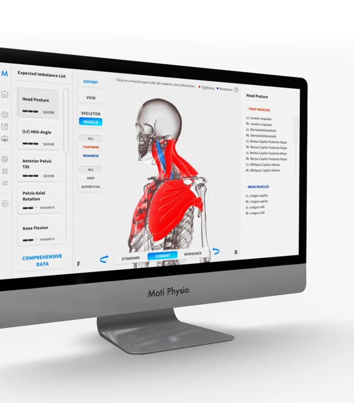 Moti Physio Mobile/Tablet Hero